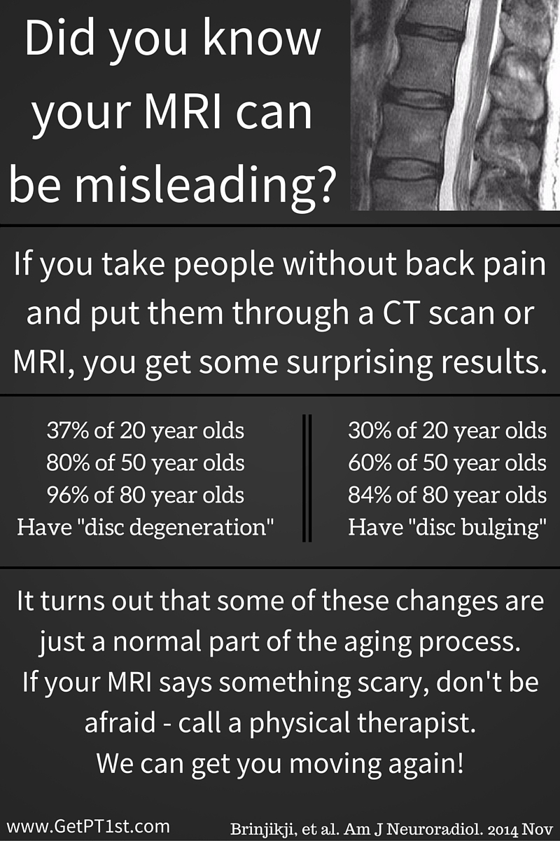 did-you-know-your-mri-can-be-misleading