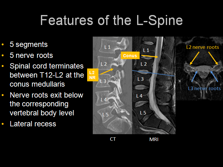 l_spine